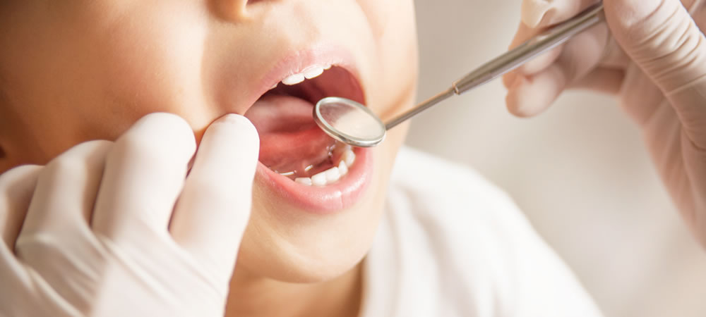 シーラントの効果