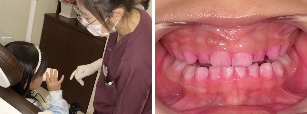 染め出し液でゆすぐ