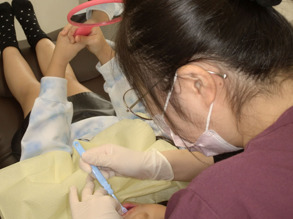 TBI(歯磨き指導)