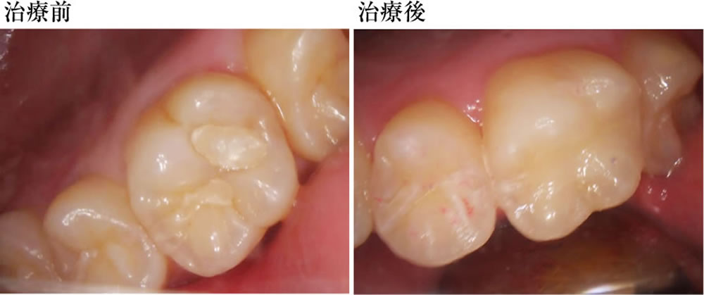 治療前後の比較
